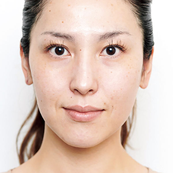 荒井さん_before