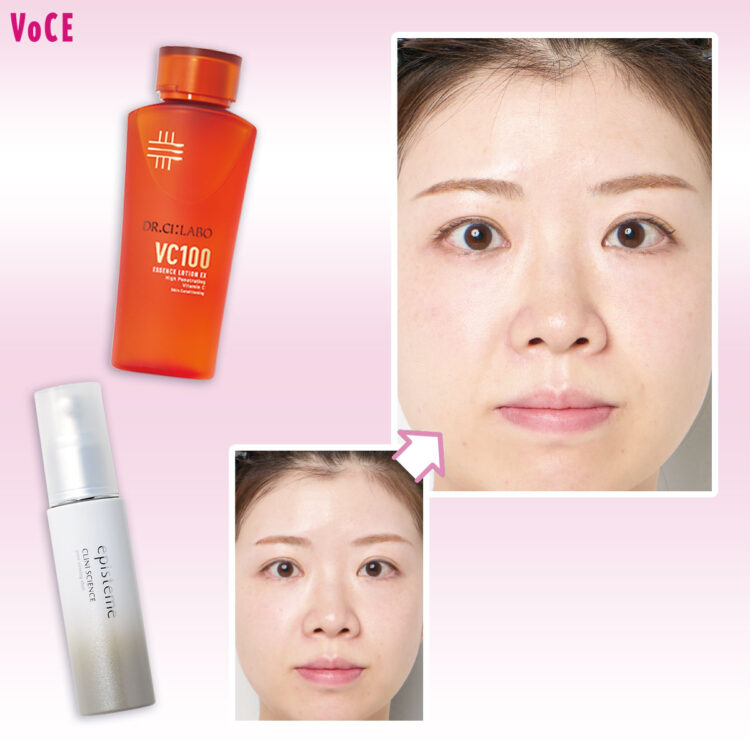 VO-2508-146-TOP-750x750.jpg