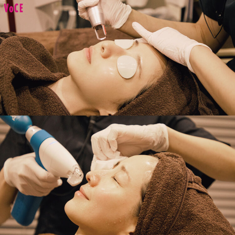 田中みな実の美容メンテ】39歳目前、“美容医療で肌管理”を始めました