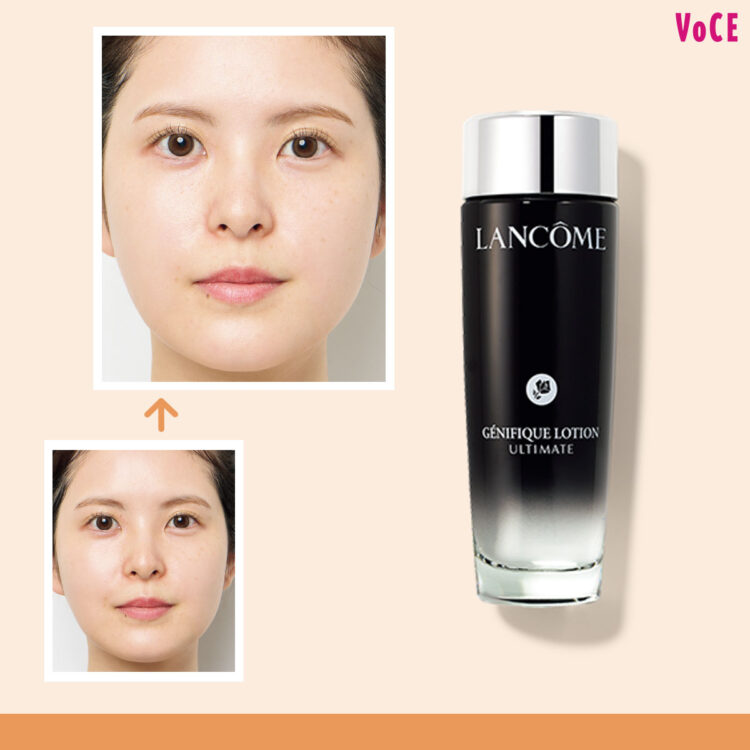 くすみ＆赤み】を3週間で撃退する本命化粧水【スキンケアNEWS