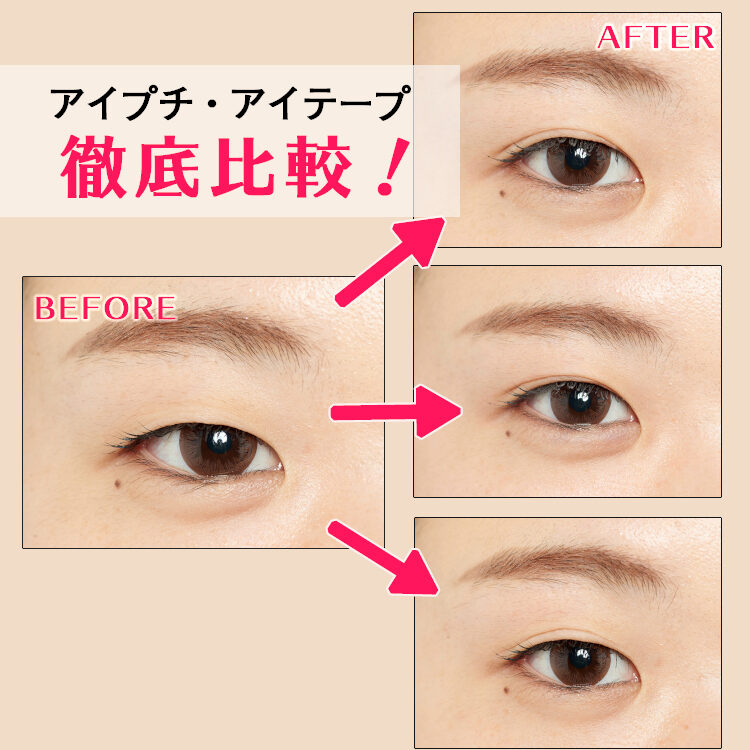 比較検証】絶対二重にならない一重にもおすすめなアイプチ® はあの定番