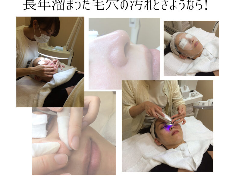 毛穴ケア専門サロン ウビクエ 初体験 長年溜まった毛穴の汚れとさようなら ビューティニュース 美容メディアvoce ヴォーチェ